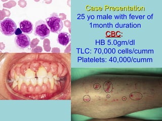 Case PresentationCase Presentation
25 yo male with fever of
1month duration
CBCCBC::
HB 5.0gm/dl
TLC: 70,000 cells/cumm
Platelets: 40,000/cumm
 