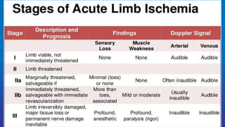 Diagnosis and management of Acute limb -ischemia (1).ppt