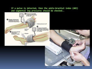 If a pulse is detected, then the ankle-brachial index (ABI)
and segmental leg pressures should be checked..
sumeryadav2004@gmail.com
 