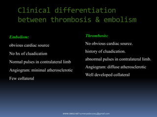 WWW.SMSO.NET
Embolism:
obvious cardiac source
No hx of cluadication
Normal pulses in contralateral limb
Angiogram: minimal atherosclerotic
Few collateral
Clinical differentiation
between thrombosis & embolism
Thrombosis:
No obvious cardiac source.
history of cluadication.
abnormal pulses in contralateral limb.
Angiogram: diffuse atherosclerotic
Well developed collateral
sumeryadav2004@gmail.com
 