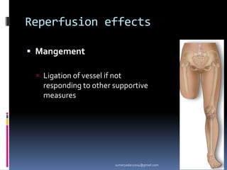 Reperfusion effects
 Mangement
 Ligation of vessel if not
responding to other supportive
measures
sumeryadav2004@gmail.com
 