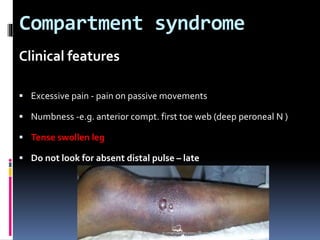 Compartment syndrome
Clinical features
 Excessive pain - pain on passive movements
 Numbness -e.g. anterior compt. first toe web (deep peroneal N )
 Tense swollen leg
 Do not look for absent distal pulse – late
sumeryadav2004@gmail.com
 
