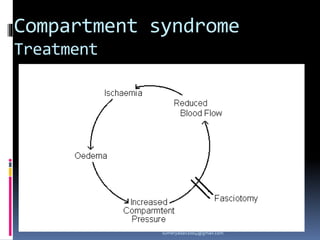 Compartment syndrome
Treatment
sumeryadav2004@gmail.com
 