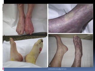 sumeryadav2004@gmail.com
 