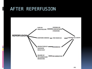 AFTER REPERFUSION
 