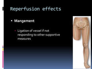 Reperfusion effects
 Mangement
 Ligation of vessel if not
responding to other supportive
measures
 