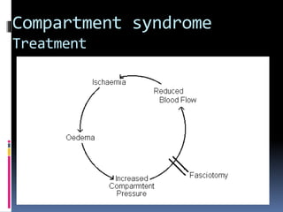 Compartment syndrome
Treatment
 