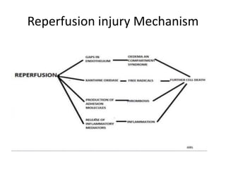 Reperfusion injury Mechanism
 
