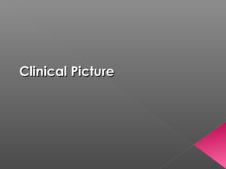 Clinical Picture
 