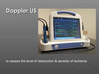 Doppler US




to assess the level of obstruction & severity of ischemia
 