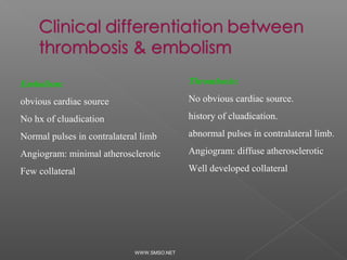 Embolism:                                   Thrombosis:

obvious cardiac source                      No obvious cardiac source.

No hx of cluadication                       history of cluadication.

Normal pulses in contralateral limb         abnormal pulses in contralateral limb.

Angiogram: minimal atherosclerotic          Angiogram: diffuse atherosclerotic

Few collateral                              Well developed collateral




                             WWW.SMSO.NET
 