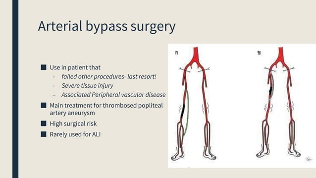 Acute limb ischemia | PPTX | First Aid | Injuries
