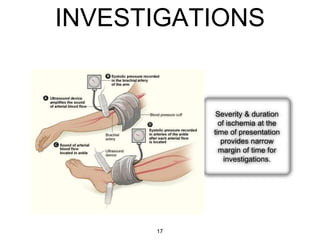 INVESTIGATIONS
Severity & duration
of ischemia at the
time of presentation
provides narrow
margin of time for
investigations.
17
 