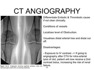 CT ANGIOGRAPHY
Differentiate Embolic & Thrombotic cause
if not clear clinically.
Conditions of vessels
Localizes level of Obstruction.
Visualises distal arterial tree and distal cut
off.
Disadvantages:
- Exposure to IV contrast –> If going to
angiography after CTA for intra-arterial
lysis of clot, patient will now receive a 2nd
contrast bolus, increasing the risk of renal
failure.
23
 