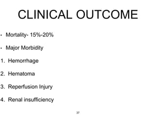 CLINICAL OUTCOME
• Mortality- 15%-20%
• Major Morbidity
1. Hemorrhage
2. Hematoma
3. Reperfusion Injury
4. Renal insufficiency
37
 