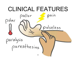 CLINICAL FEATURES
8
 