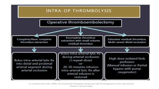 A.J. Comerota and R. Sidhu. (2009). Can Intraoperative Thrombolytic Therapy assist with the Management of Acute Limb Ischemia?
Seminars in Vascular Surgery
 