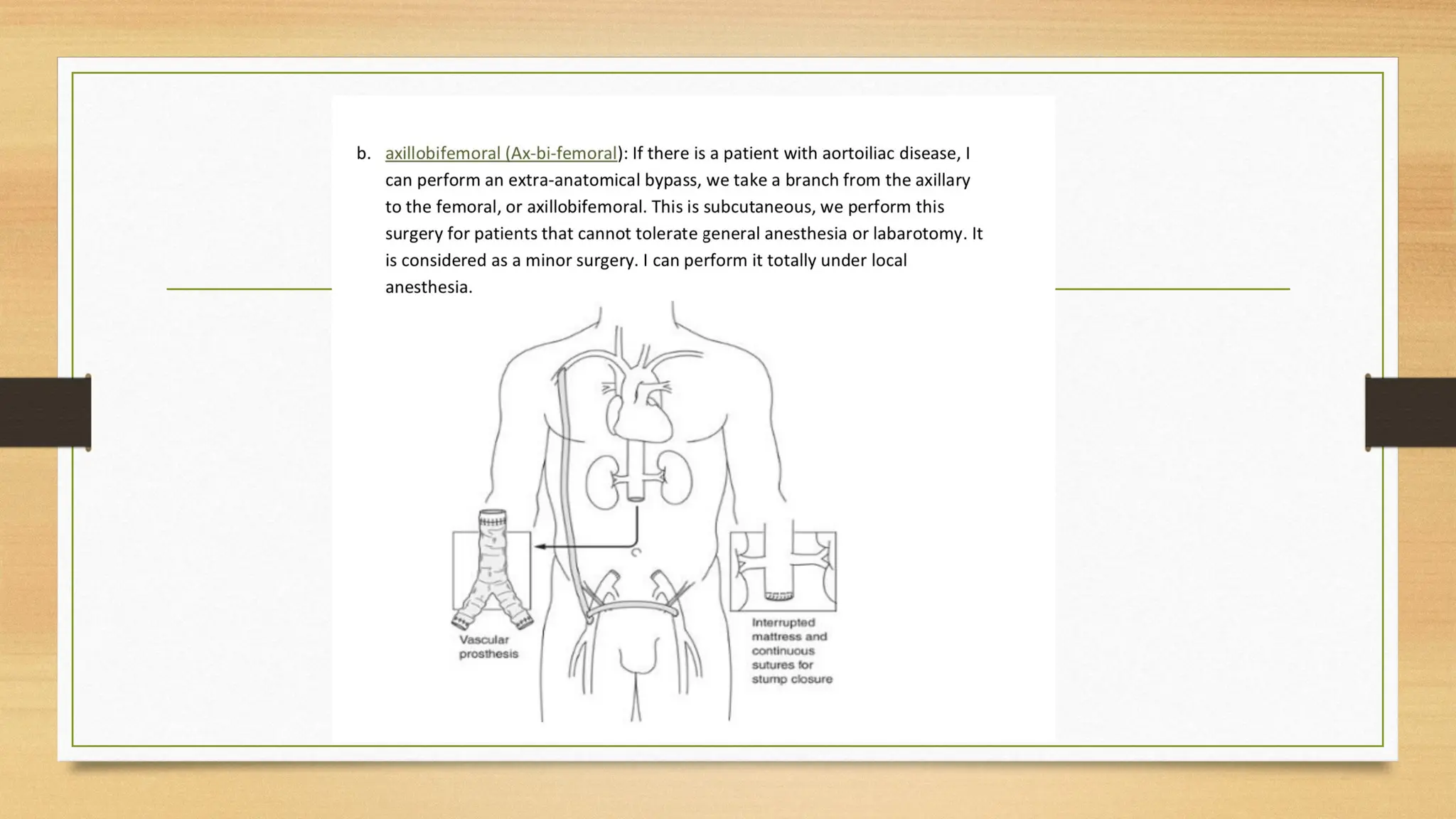 Slide of Acute limb ischemia (diagnosis, complication, management) | PPTX