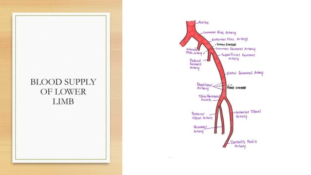 Slide of Acute limb ischemia (diagnosis, complication, management) | PPTX