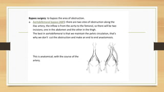Slide of Acute limb ischemia (diagnosis, complication, management) | PPTX