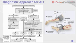 Acute Limb Ischemia and Role of DOAC.pptx