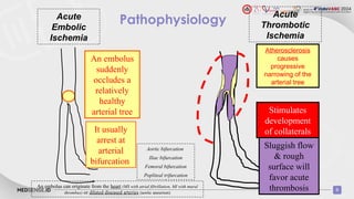 Acute Limb Ischemia and Role of DOAC.pptx