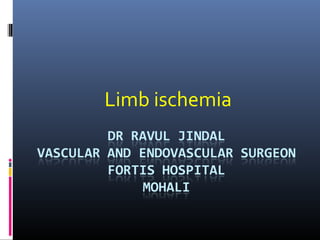 Limb ischemia
 