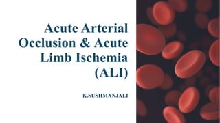 Comprehensive Overview of Acute Arterial Occlusion and Limb Ischemia ...