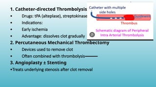 Comprehensive Overview of Acute Arterial Occlusion and Limb Ischemia ...