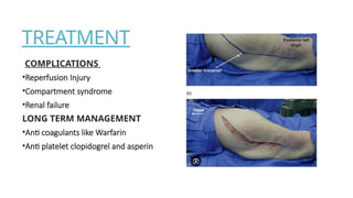 Comprehensive Overview of Acute Arterial Occlusion and Limb Ischemia ...