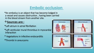 Comprehensive Overview of Acute Arterial Occlusion and Limb Ischemia ...