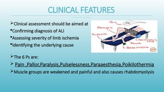 Comprehensive Overview of Acute Arterial Occlusion and Limb Ischemia ...