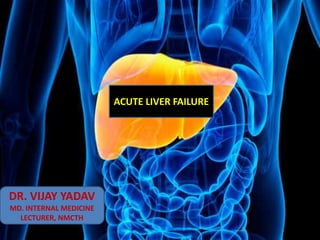 ACUTE LIVER FAILURE
DR. VIJAY YADAV
MD. INTERNAL MEDICINE
LECTURER, NMCTH
 