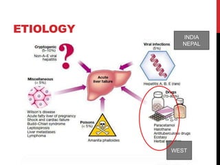 ETIOLOGY
INDIA
NEPAL
WEST
 
