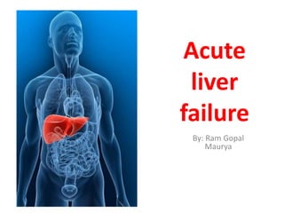 Acute
liver
failure
By: Ram Gopal
Maurya
 