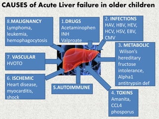 Acute liver failure in children | PPTX