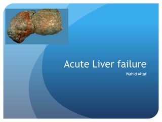 Acute Liver failure
Wahid Altaf
 