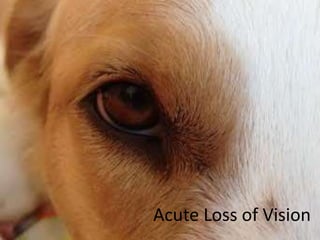 Acute Loss of Vision
 