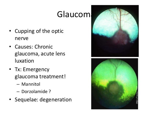 pug encephalitis treatment acute loss of vision ecc presentation pug encephalitis treatment acute loss of vision ecc presentation