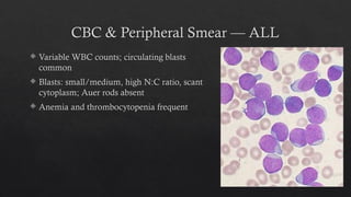 Acute Lymphoblastic Leukaemia (ALL)_Dr Dibyajyoti Prusty, MD.pptx