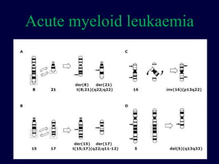 Acute myeloid leukaemia
 