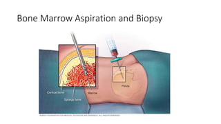 Bone Marrow Aspiration and Biopsy
 