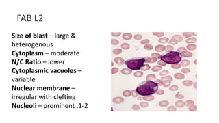 FAB L2
Size of blast – large &
heterogenous
Cytoplasm – moderate
N/C Ratio – lower
Cytoplasmic vacuoles –
variable
Nuclear membrane –
irregular with clefting
Nucleoli – prominent ,1-2
 