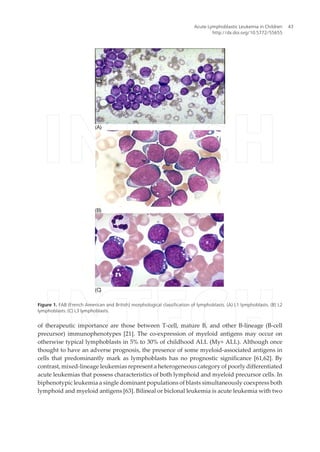 of therapeutic importance are those between T-cell, mature B, and other B-lineage (B-cell
precursor) immunophenotypes [21]. The co-expression of myeloid antigens may occur on
otherwise typical lymphoblasts in 5% to 30% of childhood ALL (My+ ALL). Although once
thought to have an adverse prognosis, the presence of some myeloid-associated antigens in
cells that predominantly mark as lymphoblasts has no prognostic significance [61,62]. By
contrast, mixed-lineage leukemias represent a heterogeneous category of poorly differentiated
acute leukemias that possess characteristics of both lymphoid and myeloid precursor cells. In
biphenotypic leukemia a single dominant populations of blasts simultaneously coexpress both
lymphoid and myeloid antigens [63]. Bilineal or biclonal leukemia is acute leukemia with two
(A)
(B)
(C)
Figure 1. FAB (French American and British) morphological classification of lymphoblasts. (A) L1 lymphoblasts. (B) L2
lymphoblasts. (C) L3 lymphoblasts.
Acute Lymphoblastic Leukemia in Children
http://dx.doi.org/10.5772/55655
43
 