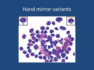 Hand mirror variants
 