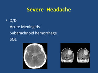 Severe Headache
• D/D
  Acute Meningitis
  Subarachnoid hemorrhage
  SOL
 
