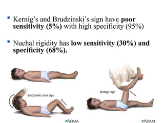  Kernig’s and Brudzinski’s sign have poor
sensitivity (5%) with high specificity (95%)
 Nuchal rigidity has low sensitivity (30%) and
specificity (68%).
 