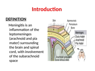 DEFINITION
Meningitis is an
inflammation of the
leptomeninges
(arachnoid and pia
mater) surrounding
the brain and spinal
cord, with involvement
of the subarachnoid
space
Introduction
 