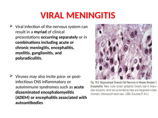  Viral infection of the nervous system can
result in a myriad of clinical
presentations occurring separately or in
combinations including acute or
chronic meningitis, encephalitis,
myelitis, ganglionitis, and
polyradiculitis.
 Viruses may also incite para- or post-
infectious CNS inflammatory or
autoimmune syndromes such as acute
disseminated encephalomyelitis
(ADEM) or encephalitis associated with
autoantibodies
VIRAL MENINGITIS
 