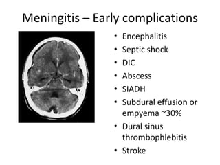 Meningitis – Early complications
• Encephalitis
• Septic shock
• DIC
• Abscess
• SIADH
• Subdural effusion or
empyema ~30%
• Dural sinus
thrombophlebitis
• Stroke
 